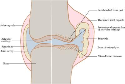 Emerging pharmaceutical therapeutics and delivery technologies for osteoarthritis therapy